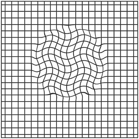 https://www.eyeutica.com/wp-content/uploads/amsler-grid-wavy.jpg